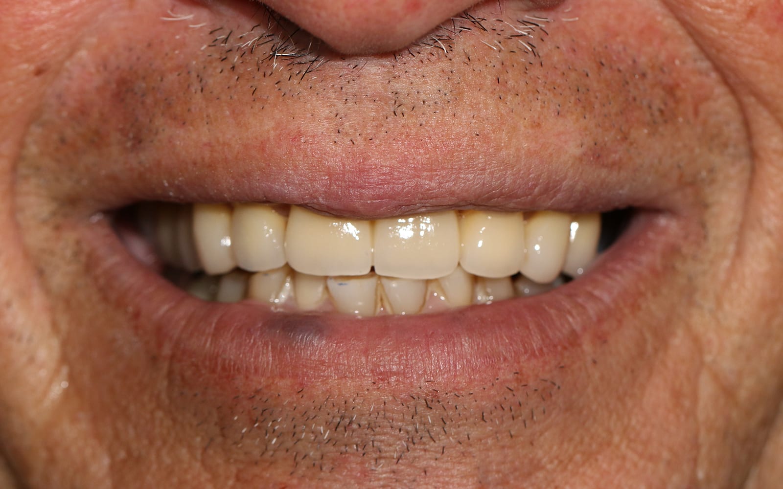 Before and After - Stunning Dental Treatment Results