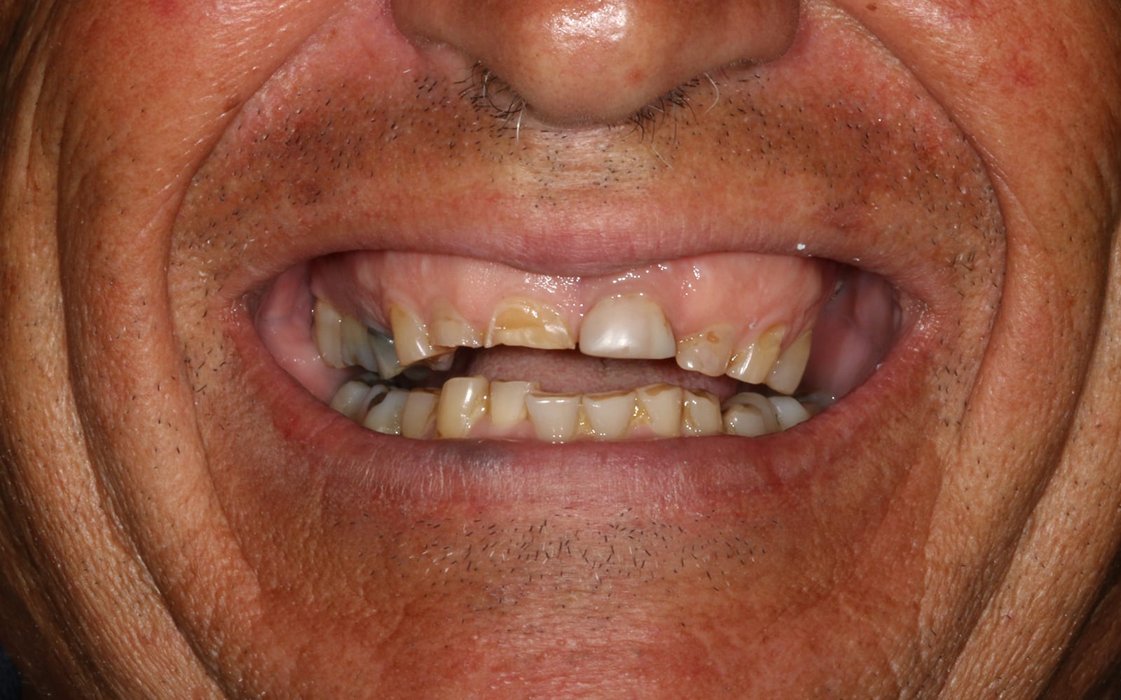 Before and After - Stunning Dental Treatment Results